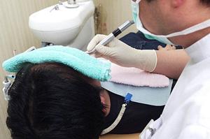 仙台で見つける！効果的なAGA治療法とおすすめクリニックガイド