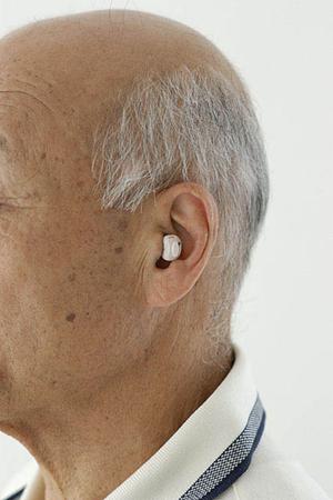 堺市の歯医者で知覚過敏の治療を受ける