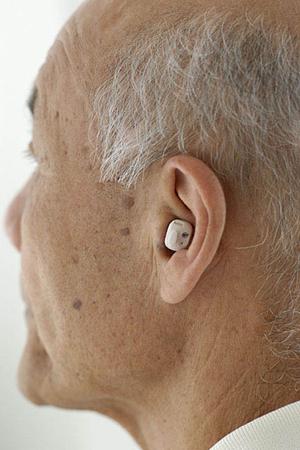 患者に適した矯正が可能な朝霞の治療