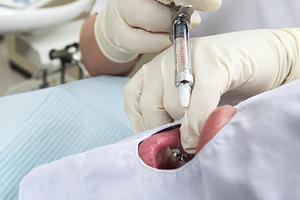 最新2025年版！博多で見つかる信頼の矯正歯科クリニックと選び方ガイド