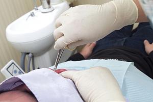 足立区の矯正まで頼れる小児歯科