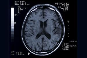 京都で見つける理想の歯並び！矯正歯科の選び方と治療法ガイド